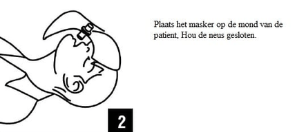 VCTparts Kiss of Life Beademingsdoekje voor Hygiënisch Reanimeren Veilig Beademen met Eenrichtingsventiel FAMC 6