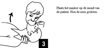 VCTparts Kiss of Life Beademingsdoekje voor Hygiënisch Reanimeren Veilig Beademen met Eenrichtingsventiel FAMC 7
