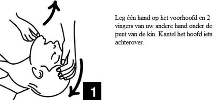 VCTparts Kiss of Life Beademingsdoekje voor Hygiënisch Reanimeren Veilig Beademen met Eenrichtingsventiel FAMC 5